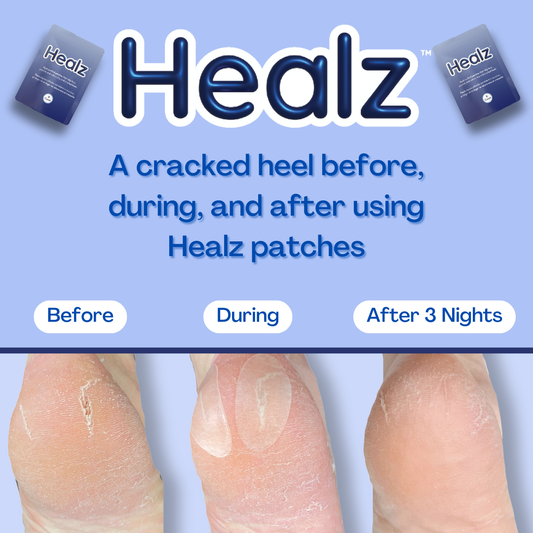 Healz Hydrocolloid Patches – Heal, Protect, and Relieve Painful Cracked Heels